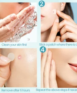 Fivfivgo™ ClariFace Overnight Acne Patches
