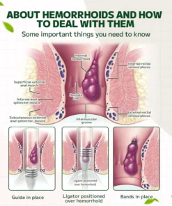 Fivfivgo™ Hemorrhoidal Ointment