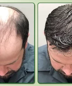 Fivfivgo™ LuxtroPro Ätherisches Rosmarinöl