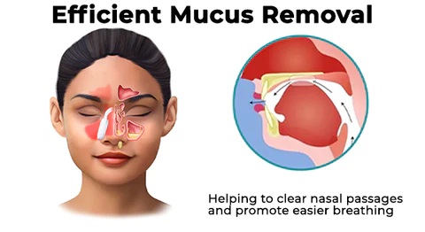 Fivfivgo™ Nasal Mucus Cleaning Device
