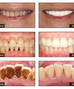 Fivfivgo™ Niacinamid Whitening Zahnpasta