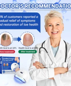 Fivfivgo™ PureNail Fungus Laser Therapie Gerät