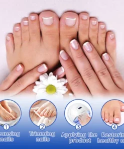 Fivfivgo™ PureNail Fungus Laser Therapie Gerät