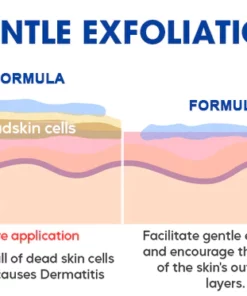 Fivfivgo™ Seborrhoische Dermatitis Creme