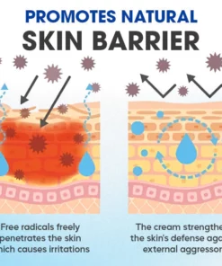 Fivfivgo™ Seborrheic Dermatitis Cream