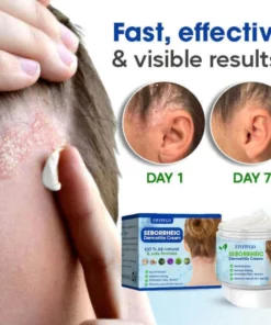 Fivfivgo™ Seborrhoische Dermatitis Creme