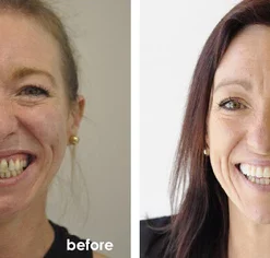 Fivfivgo™ Shark Cartilage Protein Dental Regrowth Drops