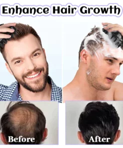 Fivfivgo™ SootheScalp Pro Massagebürste