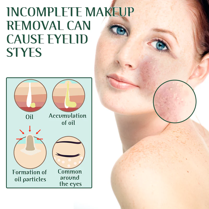 Fivfivgo™ Tea Tree Terpineol Eye Mite Removal Wipes