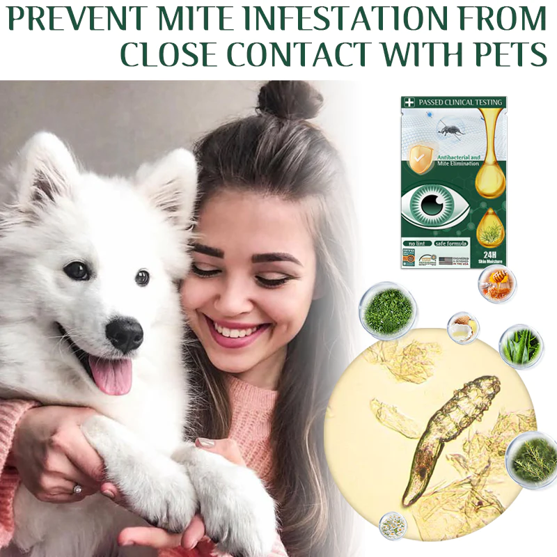 Fivfivgo™ Tea Tree Terpineol Eye Mite Removal Wipes