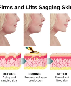 Fivfivgo™ VorSculpt V-Gesichtsformungsgerät