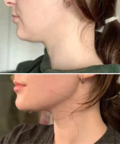 Fivfivgo™ VorSculpt V-Gesichtsformungsgerät