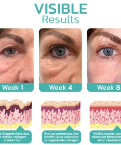 Furzero™ CELYN Peptide Taut Eye Cream