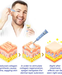 Furzero™ EyesCream Peptide Lifting Cream