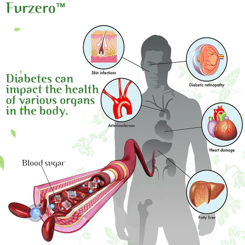 Furzero™ Herbal Blood Sugar Control Inhaler