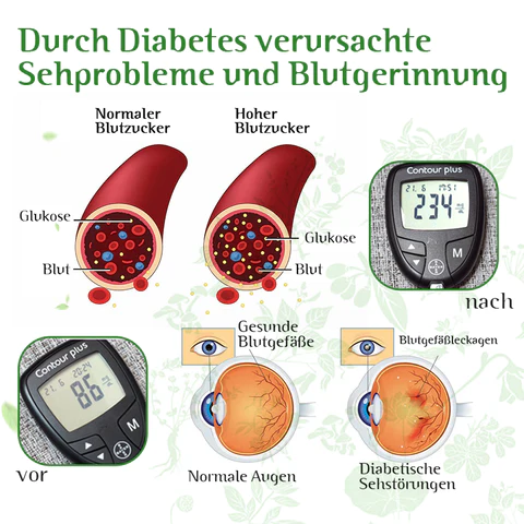 Furzero™ Kräuterblutzucker-Kontrollinhalator