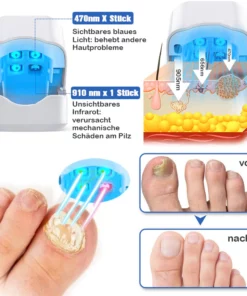 Furzero™ Nagelpilz-Laserbehandlungsgerät