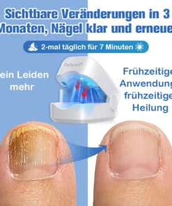 Furzero™ Nagelpilz-Laserbehandlungsgerät