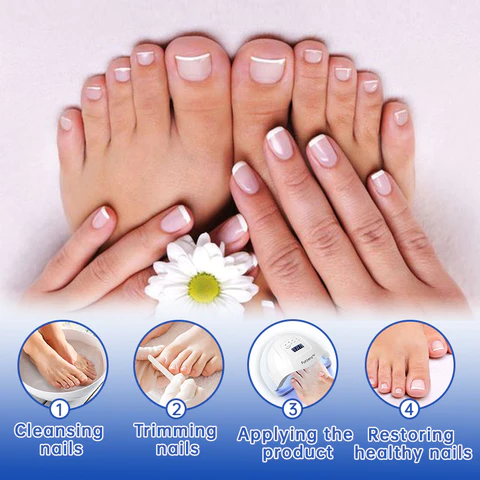 Furzero™ PureNail Fungus Laser Therapy Device