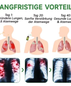 Furzero™️ Atementgiftendes Kräuterlungenreinigungsspray