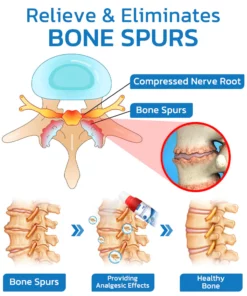 GFOUK™ Bonjunction Shark Collagen Support Spray