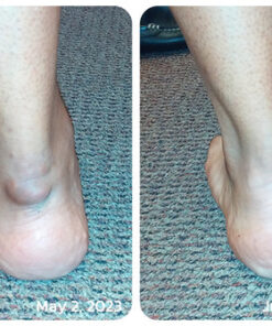 GFOUK™ Bonjunction Shark Collagen Support Spray