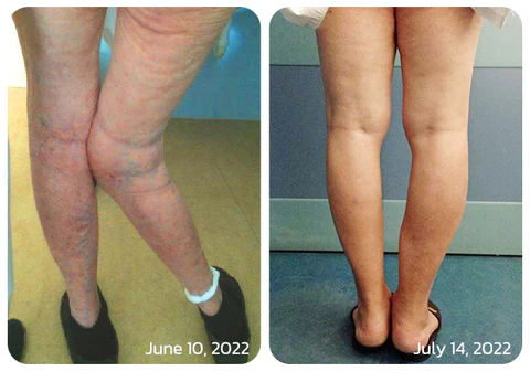 GFOUK™ Bonjunction Shark Collagen Support Spray