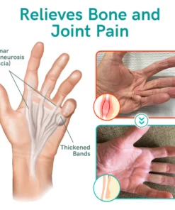 GFOUK™ Collagenase and Bone Therapy Cream
