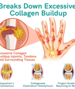 GFOUK™ Collagenase and Bone Therapy Cream
