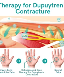 GFOUK™ Collagenase and Bone Therapy Cream