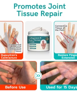 GFOUK™ Collagenase and Bone Therapy Cream