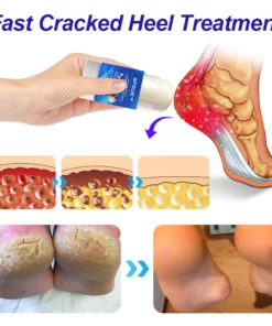 GFOUK™ Intensive Repair Cream For Cracked Heels