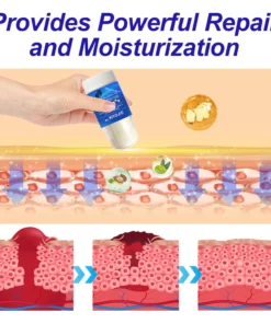 GFOUK™ Intensive Repair Cream For Cracked Heels