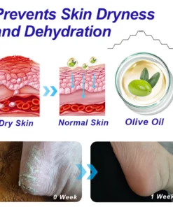 GFOUK™ Intensive Repair Cream For Cracked Heels