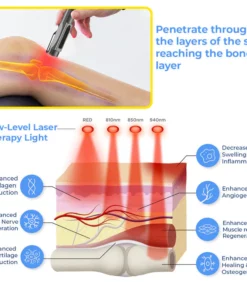 GFOUK™ MedicWave Thermal Laser Joint Care Pen