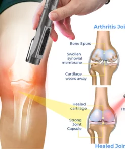 GFOUK™ MedicWave Thermal Laser Joint Care Pen