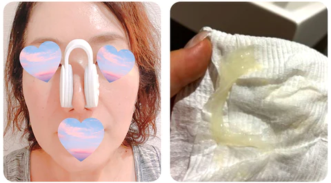 GFOUK™ Nasal Mucus Cleaning Device