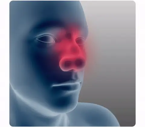 GFOUK™ Nasal Mucus Cleaning Device