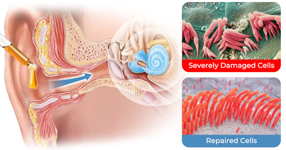 GFOUK™ OrganicHear Anti EarInfections and Tinnitus Relief Serum