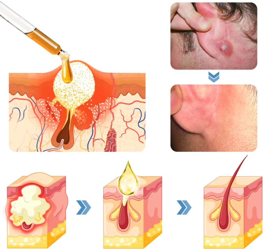 GFOUK™ OrganicHear Anti EarInfections and Tinnitus Relief Serum