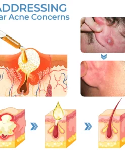 GFOUK™ OrganicHear Anti EarInfections and Tinnitus Relief Serum