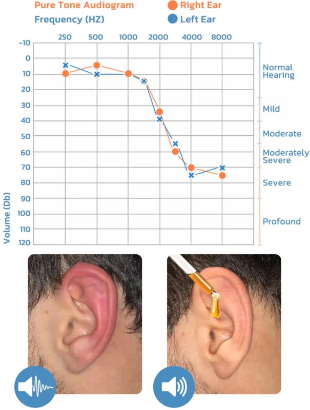 GFOUK™ OrganicHear Anti EarInfections and Tinnitus Relief Serum