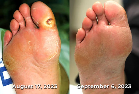 GFOUK™ SugarGuard Far Infrared Pro Nasal Device