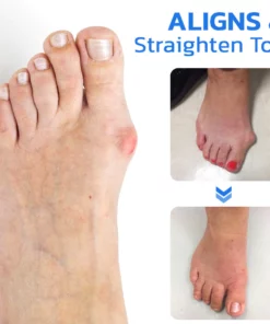 GFOUK™ ToebeJoin Correct Pression Patch