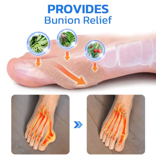 GFOUK™ ToebeJoin Correct Pression Patch