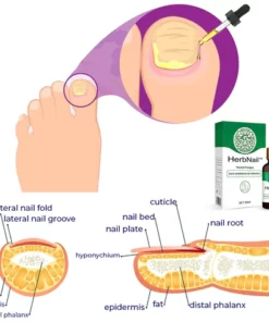 HerbNail™ Toenail Fungus Care Antibacterial Solution