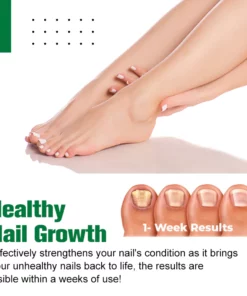 HerbNail™ Toenail Fungus Care Antibacterial Solution