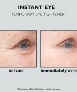 Instant Eye Temporary Eye Tightener