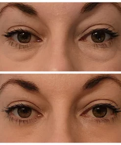 Instant Eye Temporary Eye Tightener