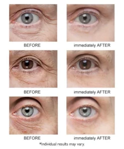 Instant Eye Temporary Eye Tightener